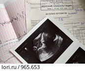 УЗИ-снимок, КТГ плода и анализ крови (2009 год). Редакционное фото, фотограф Liseykina / Фотобанк Лори