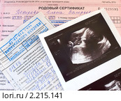 УЗИ-снимок, родовый сертификат и обменная карта (2010 год). Редакционное фото, фотограф Liseykina / Фотобанк Лори