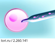 Экстракорпоральное оплодотворение, планирование пола, девочка - спермии с Х-хромосомой. Стоковая иллюстрация, иллюстратор Анастасия Некрасова / Фотобанк Лори