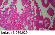 Аскарида под микроскопом, фон (Ascaris lumbricoides) Стоковое видео, видеограф Артем Поваров / Фотобанк Лори