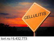 Cellulitis, дорожный знак на фоне вечернего неба. Стоковое фото, фотограф Илья Урядников / Фотобанк Лори