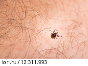 Tick - parasitic arachnid blood-sucking carrier of various diseases. Стоковое фото, фотограф Viktor Cap / PantherMedia / Фотобанк Лори