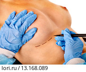 Doctor makes dotted line on female breast . Стоковое фото, фотограф Gennadiy Poznyakov / Фотобанк Лори