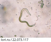 Личинка Toxocara canis второй стадии развития. Стоковое фото, фотограф Руднева Ольга / Фотобанк Лори