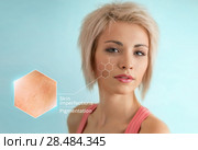 Bright closeup portrait of beautiful woman with skin crops. Skincare concept. Стоковое фото, фотограф Kirill Kedrinskiy / Ingram Publishing / Фотобанк Лори