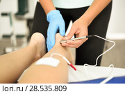 Electroacupuncture dry with needle on female ankle. Стоковое фото, фотограф Javier Sánchez Mingorance / Ingram Publishing / Фотобанк Лори