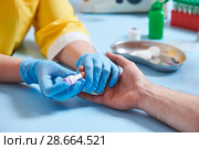 Blood testor research. Piercing male finger for blood examitation analysis in hospital. Стоковое фото, фотограф Дмитрий Калиновский / Фотобанк Лори