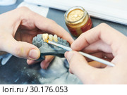 dental prosthesis work. Painting teeth. Стоковое фото, фотограф Дмитрий Калиновский / Фотобанк Лори