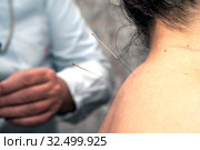 Лечение иглоукалыванием. Стоковое фото, фотограф Сергей Афанасьев / Фотобанк Лори
