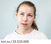 Надменное выражение лица, девочка закатила глаза. Стоковое фото, фотограф Кекяляйнен Андрей / Фотобанк Лори