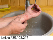 Мужчина промывает рану на руке под струей воды в умывальнике. Стоковое фото, фотограф Иванов Алексей / Фотобанк Лори