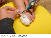 Руки девушки сделали медицинскую повязку на большом пальце ноги ребенка и отрезают излишек бинта. Стоковое фото, фотограф Иванов Алексей / Фотобанк Лори