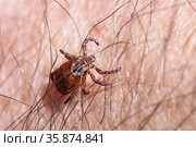 Blood-sucking mite on a human skin macro. Стоковое фото, фотограф Георгий Дзюра / Фотобанк Лори