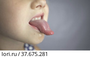Kid salivation girl opens her mouth child shows his teeth soft palate and mouth to dentist. mouth is wide open, tongue is stuck out as far as possible, with clear view of tongue. Стоковое видео, видеограф Ирина Ткачук / Фотобанк Лори