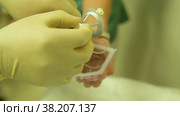 Opens packaging eye disposable microsurgery surgery operation equipment procedure, for, cataract instrument. Стоковое видео, видеограф ilya Lyubchenko / Фотобанк Лори