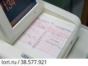 Медицинская аппаратура. Снятие медицинских показаний. Электрокардиограмма матери и ребенка. Medical equipment. Removal of medical indications. Electrocardiogram of mother and child (2017 год). Редакционное фото, фотограф Алексей Смышляев / Фотобанк Лори