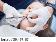 Braces for child teeth correction. Installation and maintenace. Стоковое фото, фотограф Дмитрий Калиновский / Фотобанк Лори