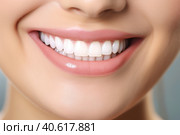 Woman teeth before and after whitening. Over white background. Generative AI. Стоковое AI-изображение, AI-художник Ирина Ручушкина / Фотобанк Лори
