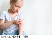 Ребенок чешет атопичную кожу. Дерматит, диатез, аллергия на теле ребенка. Стоковое фото, фотограф Терехова Марина / Фотобанк Лори