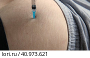 Needle injecting into the muscle. Nurse doing a trigger point injection in patient back. Close up doctor makes an shot therapy. Alternative pain treatment. Covid-19, pox, MPOX, flu virus vaccine. Стоковое видео, видеограф Марина Демидюк / Фотобанк Лори