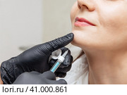 Plastic surgery. Young woman receiving botox injection in the chin at beauty clinic, closeup, copy space. Стоковое фото, фотограф Ирина Михайличенко / Фотобанк Лори