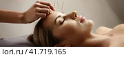 Woman undergoing acupuncture therapy procedure on facial skin in spa salon. Doctor hand with a needle near a girl face. Стоковое AI-изображение, AI-художник Igor Tichonow / Фотобанк Лори