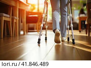 Women Using Crutches. Person After Accident. Стоковое AI-изображение, AI-художник Ярославский Максим / Фотобанк Лори