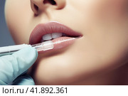 Young woman getting botox cosmetic injection in the lips, the concept of skin care, aesthetic medicine, cosmetology and anti-aging, AI Generated. Стоковое AI-изображение, AI-художник Станислав Тарко / Фотобанк Лори