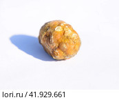Stone of gallbladder. The result of gallstones. A calculus of heterogeneous composition. Стоковое фото, фотограф Леонид Еремейчук / Фотобанк Лори