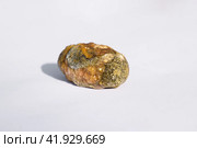 Stone of gallbladder. The result of gallstones. A calculus of heterogeneous composition. Стоковое фото, фотограф Леонид Еремейчук / Фотобанк Лори