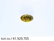Large gallstone, Gall bladder stone. result of gallstones. Calculus of heterogeneous composition. Стоковое фото, фотограф Леонид Еремейчук / Фотобанк Лори