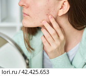 Young woman with problem skin looking at mirror and sees blackheads on skin. Стоковое фото, фотограф Natalia Gdovskaia / Фотобанк Лори