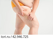Overweight woman, fat legs with varicose veins and stretch marks, obesity female body with cellulite on gray background. Стоковое фото, фотограф Станислав Тарко / Фотобанк Лори