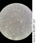 HEK 293 (англ. Human Embryonic Kidney) - клеточная линия, полученная из эмбриональных почек человека. Стоковое фото, фотограф Alex / Фотобанк Лори