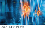 High-tech computer model of a leg with an inflamed knee joint. X-ray of the knee joint. Стоковое AI-изображение, AI-художник Александр Довянский / Фотобанк Лори