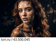Leukoderma. Vitiligo. Violation of skin pigmentation. Large white spots all over the body and face. Portrait of a beautiful girl with a skin disease. Стоковое AI-изображение, AI-художник Photojuli / Фотобанк Лори