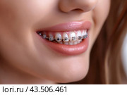Close-up portrait of a smiling woman with orthodontic braces. Стоковое AI-изображение, AI-художник Katsiaryna Repich / Фотобанк Лори