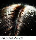 Dandruff problem. A head with itchy head. Стоковое AI-изображение, AI-художник Виктор Застольский / Фотобанк Лори