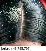 Dandruff problem. A head with itchy head. Стоковое AI-изображение, AI-художник Виктор Застольский / Фотобанк Лори