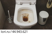 Process of cleaning the toilet from dirt. Before and after cleaning a dirty toilet bowl, time lapse. Стоковое видео, видеограф Андрей Журавлев / Фотобанк Лори
