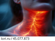 Thyroid gland inflammation, woman with pain in neck, sore throat and cough. Стоковое AI-изображение, AI-художник Станислав Тарко / Фотобанк Лори