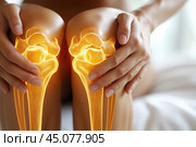 Knee pain, joint inflammation, bone fracture, woman suffering from osteoarthritis, leg injury, arthritis and degenerative changes. Стоковое AI-изображение, AI-художник Станислав Тарко / Фотобанк Лори