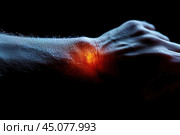 Pain in hand, carpal tunnel syndrome, health problems concept on black background. Стоковое AI-изображение, AI-художник Станислав Тарко / Фотобанк Лори