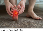 Joint diseases, hallux valgus, plantar fasciitis, leg hurts, pain in the foot. Стоковое фото, фотограф Станислав Тарко / Фотобанк Лори