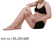Overweight woman with fat thighs, obesity female legs isolated on white background. Стоковое фото, фотограф Станислав Тарко / Фотобанк Лори