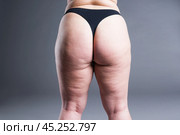 Fat female body with cellulite, overweight back, hips and buttocks. Стоковое фото, фотограф Станислав Тарко / Фотобанк Лори