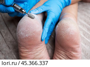 Professional hardware pedicure, elderly woman with cracked skin on her heels at a podiatrist's appointment, chiropody and podology concept. Стоковое фото, фотограф Станислав Тарко / Фотобанк Лори