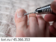 Hardware pedicure for yourself, ingrown toenail, chiropody and podology concept, foot care. Стоковое фото, фотограф Станислав Тарко / Фотобанк Лори