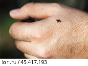 Hard-bodied tick of family Ixodidae on skin of human hand. Стоковое фото, фотограф Зарифа Арсланова / Фотобанк Лори