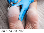 Professional hardware pedicure, elderly woman with cracked skin on her heels at a podiatrist's appointment, chiropody and podology concept. Стоковое фото, фотограф Станислав Тарко / Фотобанк Лори